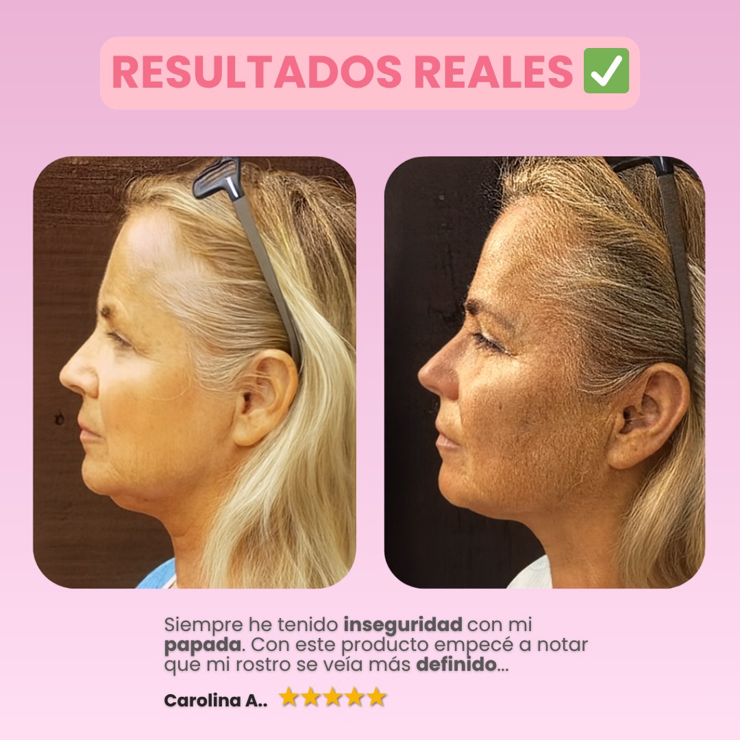 SculptMe™ Banda Reafirmante para el Rostro